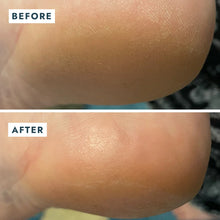 Cargar imagen en el visor de la galería, Voesh SoleMate Heel Repair Balm - Mint
